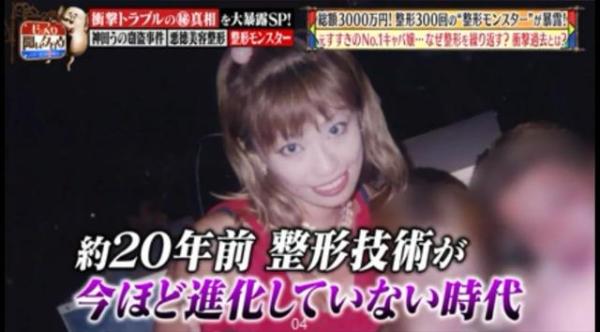 被親媽嫌醜！18歲女狂砸830萬「整形300次」 變電眼辣妹，為籌錢甘當陪酒女  自信喊：我要當模特兒