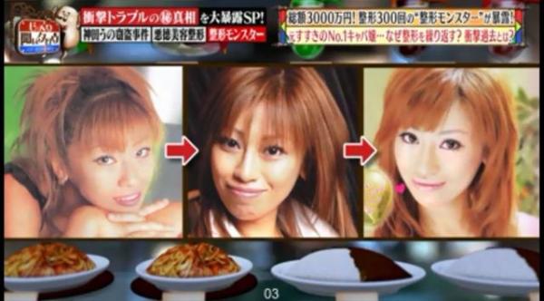 被親媽嫌醜！18歲女狂砸830萬「整形300次」 變電眼辣妹，為籌錢甘當陪酒女  自信喊：我要當模特兒