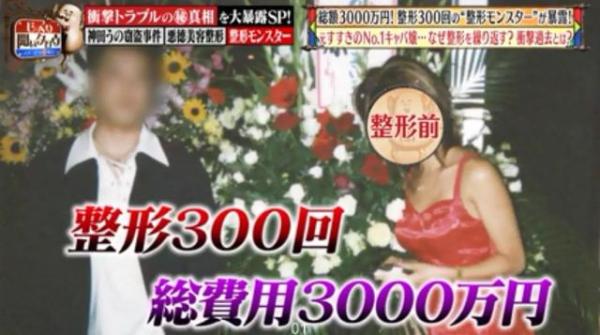被親媽嫌醜！18歲女狂砸830萬「整形300次」 變電眼辣妹，為籌錢甘當陪酒女  自信喊：我要當模特兒