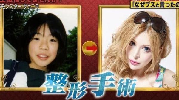 被親媽嫌醜！18歲女狂砸830萬「整形300次」 變電眼辣妹，為籌錢甘當陪酒女  自信喊：我要當模特兒