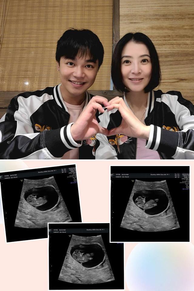恭喜結婚！李亮瑾發喜訊「早就秘密登記」：已懷孕3個月　首PO超音波照「寶寶對我們揮手」眼淚止不住
