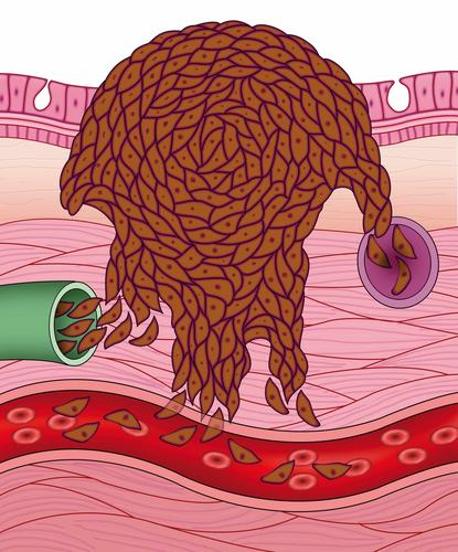 「血管堵不堵」低頭看看腿腳？身體出現3種異常表現「四肢麻木疼痛」 若都佔了「當心栓塞上身 」