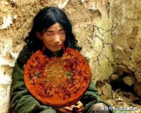 最愛成罪愛！現實版巨嬰「吃飯全靠餵」一輩子沒幹過活　 父母走後「懶得吃飯」命喪家中