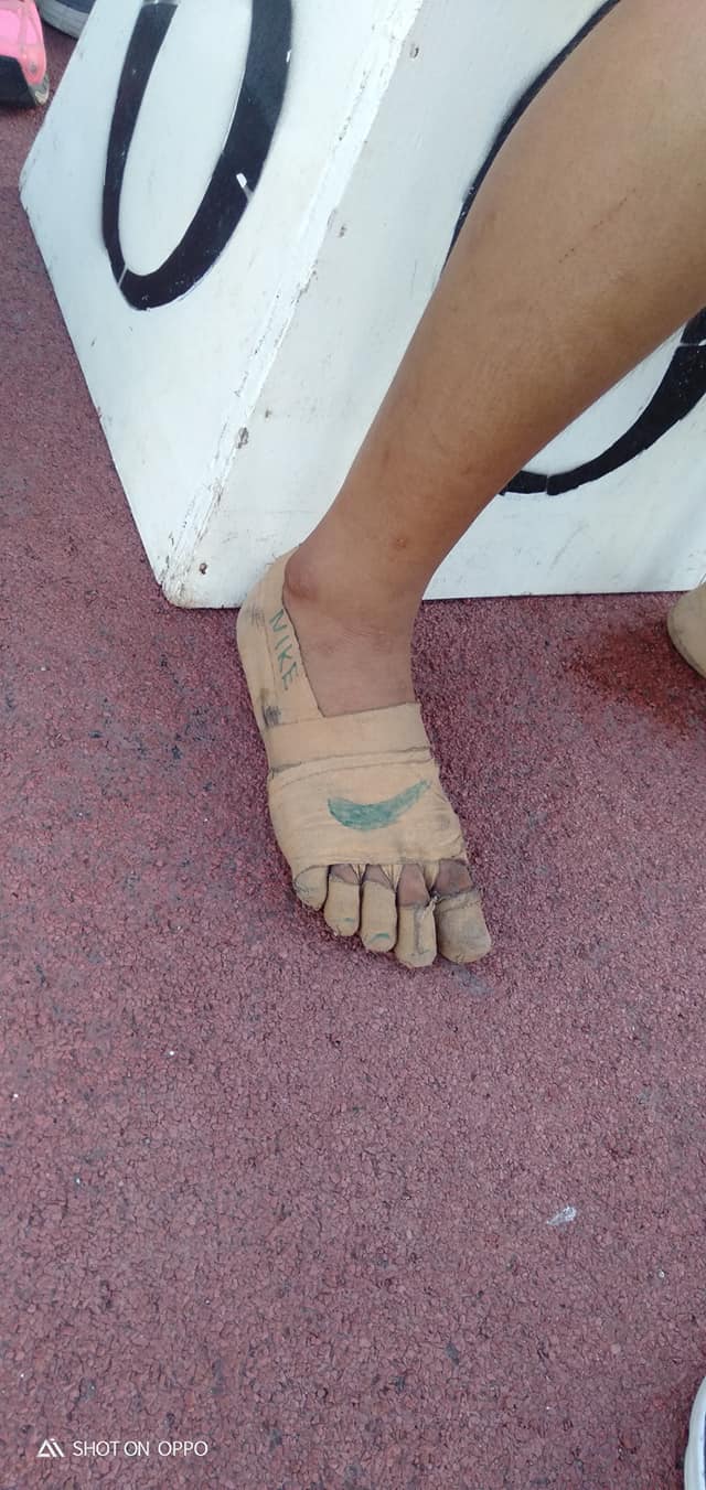 買不起球鞋！11歲女孩「膠布纏腳當鞋」還畫NIKE勾勾　忍痛奪3金牌「球鞋廠商得知後」結局太感人