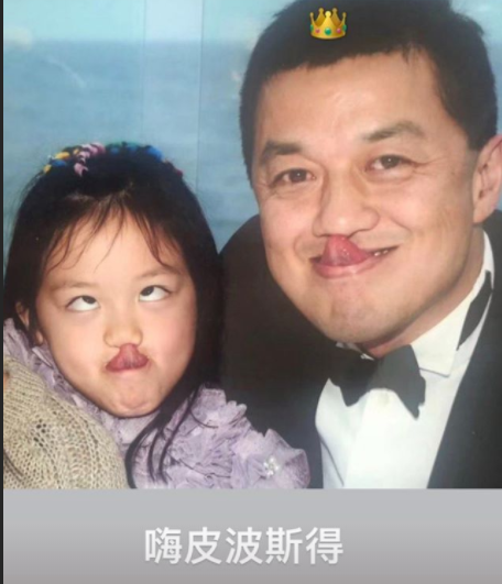 李亞鵬公開李嫣嬰兒期照片！剛做完第一次手術「嘴貼膠布」躺爸爸懷裡　父女深情對視「眼神超有愛」