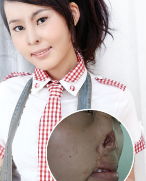 3歲被老鼠咬掉鼻子！無鼻女醜到沒公司肯錄取只好「掛牌求職」　好心人相助「大變樣」美翻全網