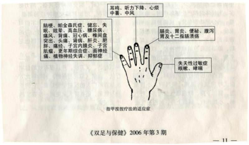 手指按摩秘術！每天堅持2分鐘日本秘方「指甲按捏療法」身上不適沒有了　「防失眠」手不麻
