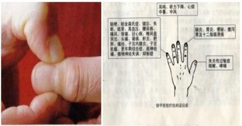 手指按摩秘術！每天堅持2分鐘日本秘方「指甲按捏療法」身上不適沒有了　「防失眠」手不麻