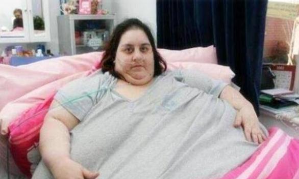 以胖為美！肉肉女「喪母後狂吃」體重飆至725kg　雙腿被壓殘卻「嫁高富帥博士」被寵成公主