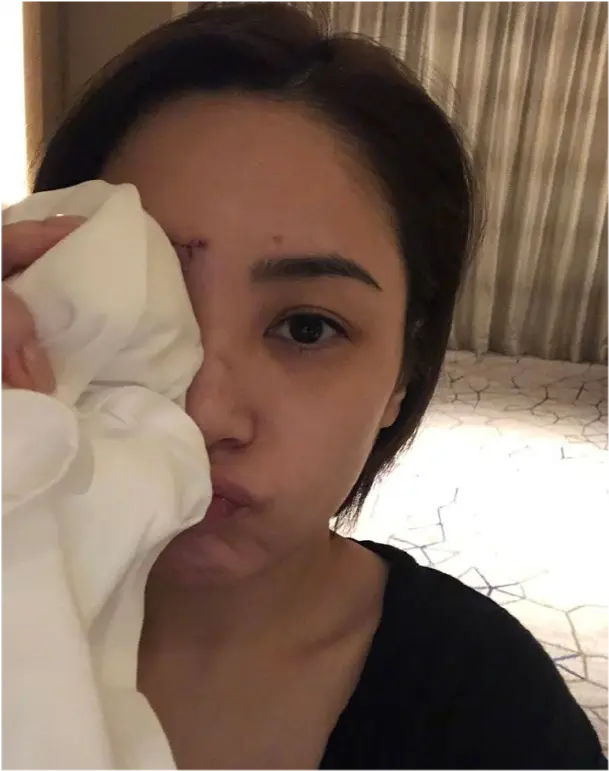 被愛情嚇怕！阿嬌受訪直言與賴弘國「無復婚可能」　自爆將「終身不再嫁」：我不適合結婚