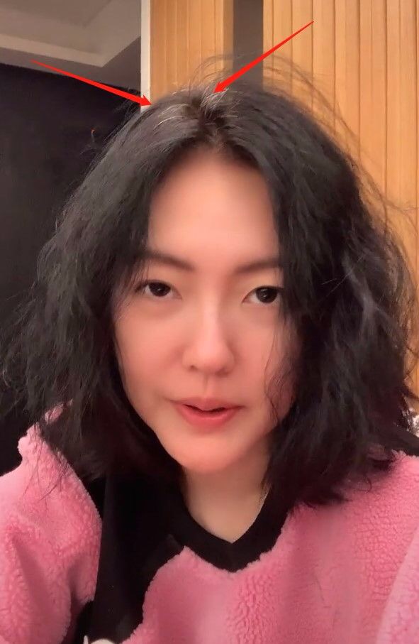 受夠了染髮！42歲小s「曬頭頂白髮」接受變老　直言讓其自由生長「曝超年輕心態」：已做好準備