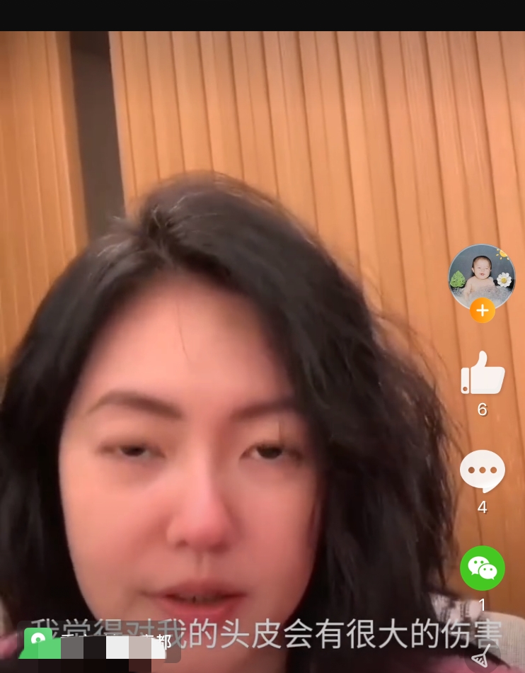 受夠了染髮！42歲小s「曬頭頂白髮」接受變老　直言讓其自由生長「曝超年輕心態」：已做好準備