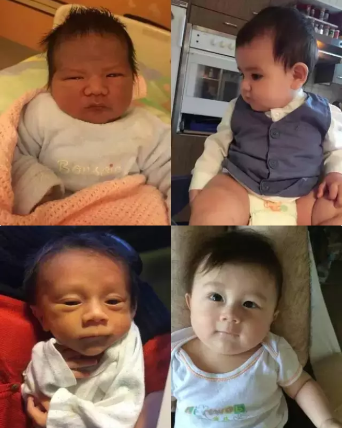 女大十八變！寶媽曬女兒「出生與5歲」時對比照　「樣貌變化」網友不敢認：確定同一個人嗎