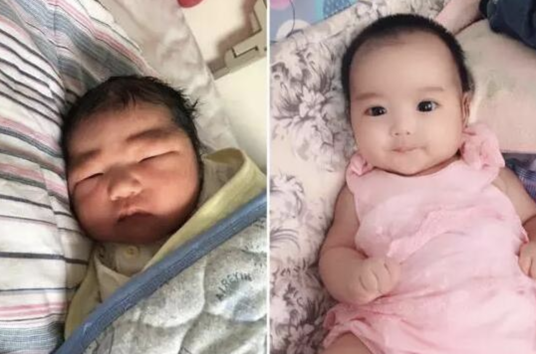女大十八變！寶媽曬女兒「出生與5歲」時對比照　「樣貌變化」網友不敢認：確定同一個人嗎
