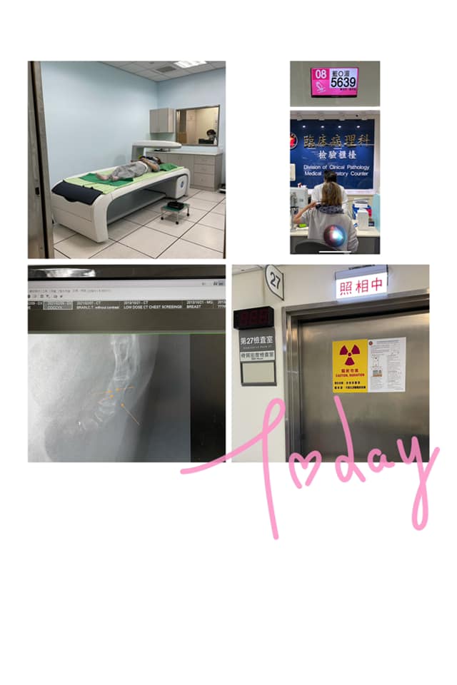 年前緊急入院！藍心湄傳浴室滑倒「倒頭栽姿勢」頭昏又吐　「檢查結果曝光」本人親自回應