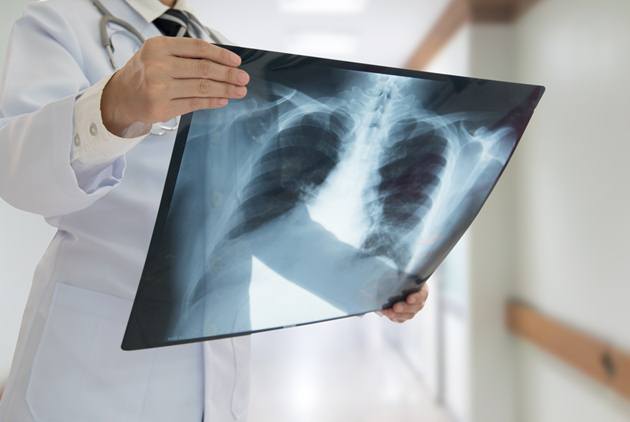 董至成「樓梯重摔輸5袋血」險丟小命！10年不注意「肺竟照出小白點」崩潰：再晚就慘了