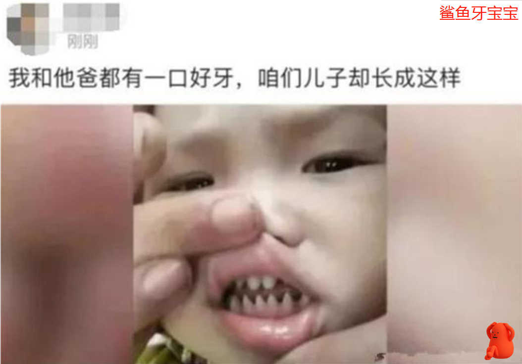 父母太無知！寶寶嘴裡長出「鯊魚牙」尖銳似釘子　家長不當回事「反覺超霸氣」醫生：害人不淺