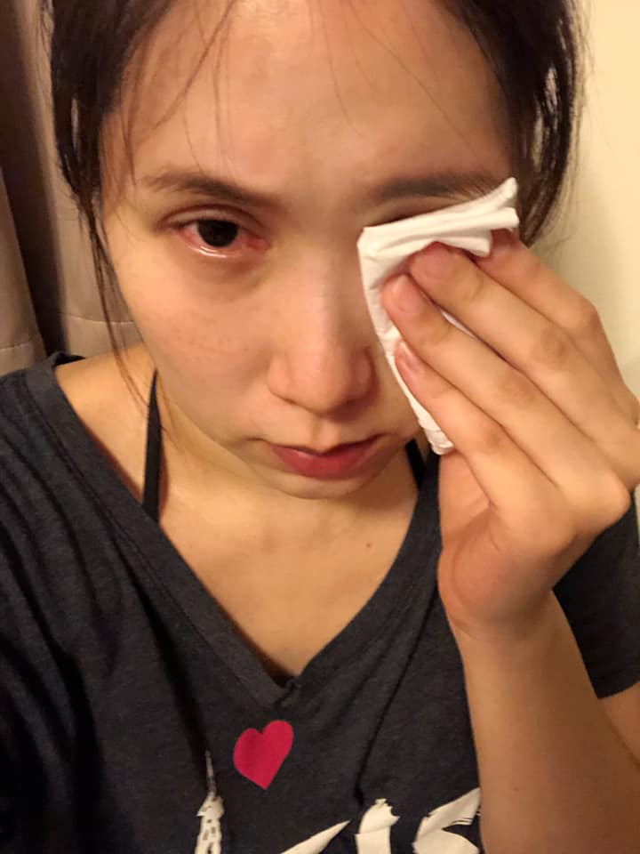 不捨尪獨撐家計！余苑綺「忍化療不適在家上工」堅強喊話惹淚　抗病6年「正向變化超勵志」感動無數病友