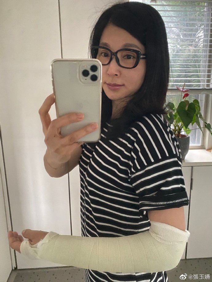 放下包袱更自在！張玉嬿不談愛「跟自己玩得很好」中年最愛溜滑板　感謝能變老「很多事以前做不到」