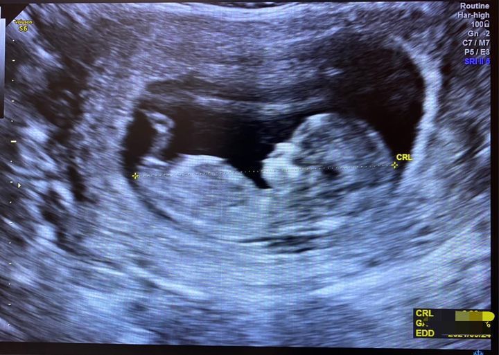 辭職帶娃被罵米蟲！人妻自白「台灣女人不願生真相」：時代變了　喊話「憑什麼要我賭上人生」句句戳心