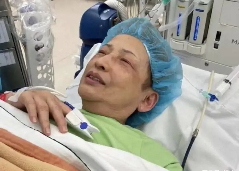 李小龍摯友！馮寶寶姐姐TVB老戲骨患大腸腺瘤「緊急入院」　5症兆預示「大腸病變」注意盡早檢查
