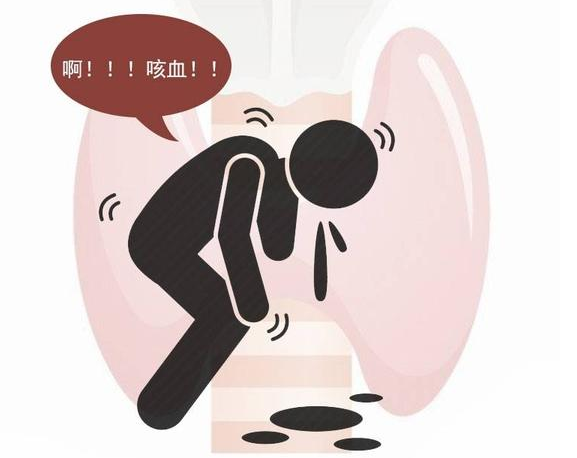 胸悶氣短是預兆！肺癌不是突然到來「上半身出現四個表現」已經預示你了　一定要盡早檢查