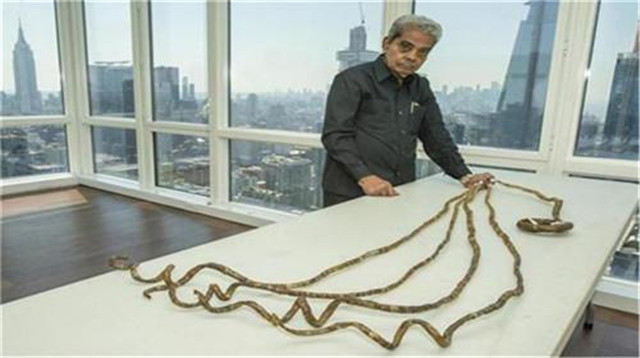 老人賭氣留44年長指甲！每晚睡覺「都不敢翻身」　剪掉捐博物館後「手指卻發生新變化」：警示了所有人