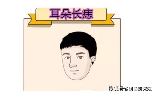命裡藏金！身上有5顆「巨富痣」的人恭喜了　祖上積德「是萬里挑一的好命」 一輩子都不缺錢花