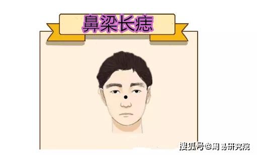 命裡藏金！身上有5顆「巨富痣」的人恭喜了　祖上積德「是萬里挑一的好命」 一輩子都不缺錢花