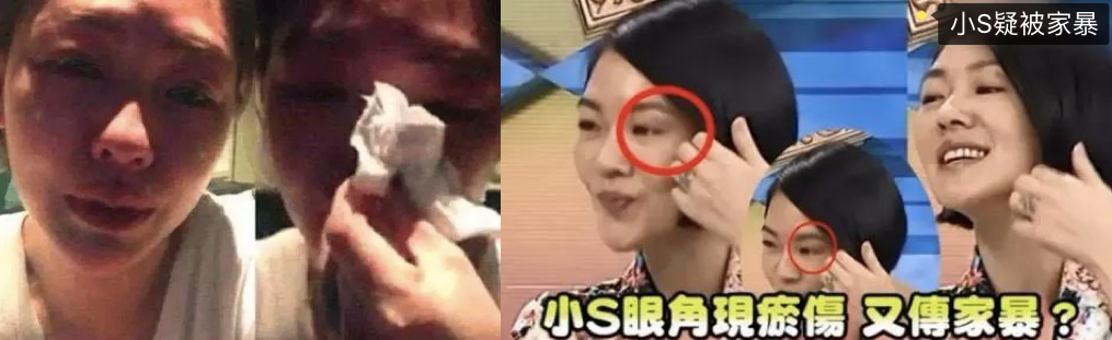 不要隨便結婚！小S「苦勸未婚女性」寂寞都比湊合強　未婚先孕的她「有苦難言」直歎：亂結婚很可怕