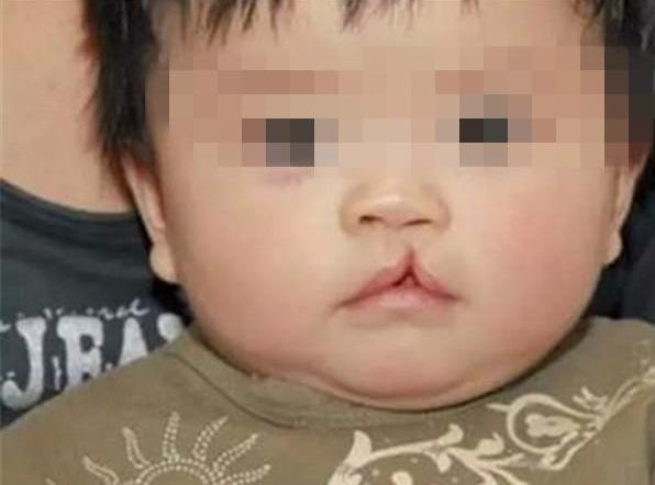 故意把3歲「兔唇」女兒弄丟！20年後兩人街頭無意相遇　「女兒現狀」卻令寶媽悔不當初 