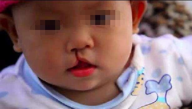 故意把3歲「兔唇」女兒弄丟！20年後兩人街頭無意相遇　「女兒現狀」卻令寶媽悔不當初 