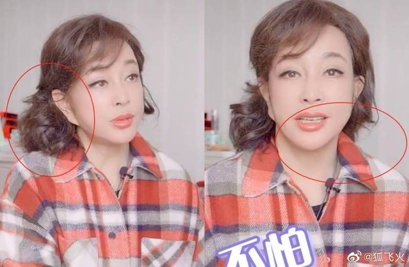被喻世界第二美魔女！資深女星「耳垂連到臉頰」被酸整太大　她大方自嘲「一句話大快人心」