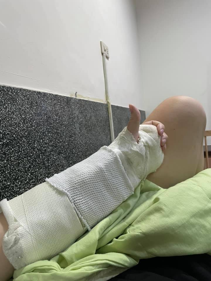 車禍無法上班！她憂「薪水會少得可憐」一查帳卻愣住　「老闆敲門拜訪」她流淚回：我不想失去工作