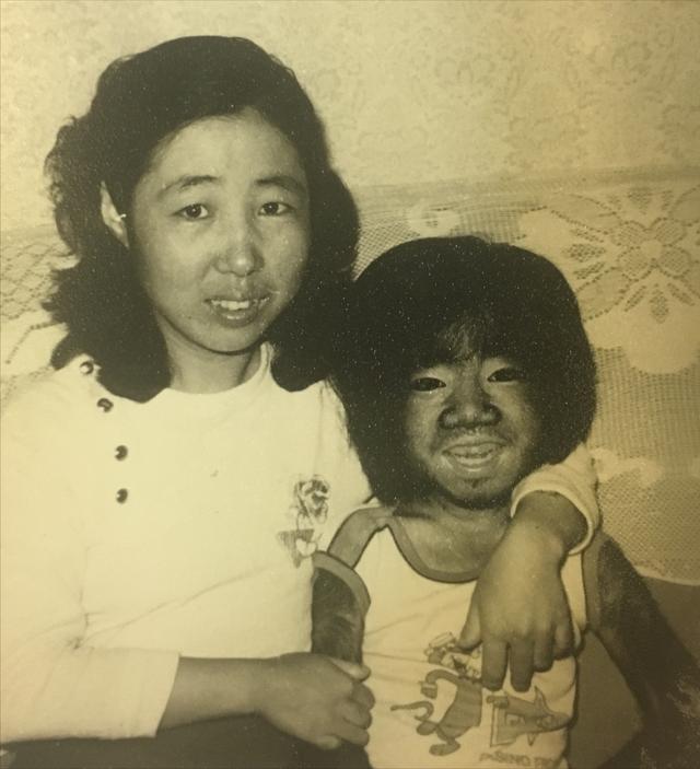 全身長滿毛！剛出生「就被科學家研究」　長大後「被人花1000萬包裝」42歲娶90後嬌妻