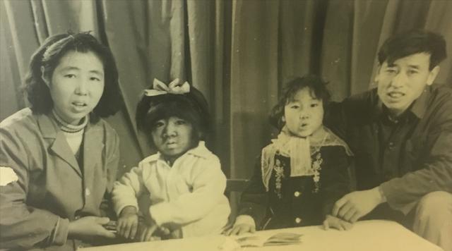 全身長滿毛！剛出生「就被科學家研究」　長大後「被人花1000萬包裝」42歲娶90後嬌妻