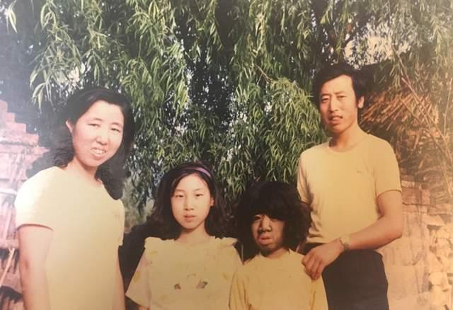 全身長滿毛！剛出生「就被科學家研究」　長大後「被人花1000萬包裝」42歲娶90後嬌妻