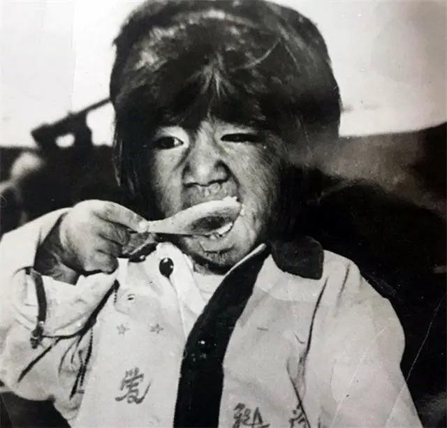 全身長滿毛！剛出生「就被科學家研究」　長大後「被人花1000萬包裝」42歲娶90後嬌妻