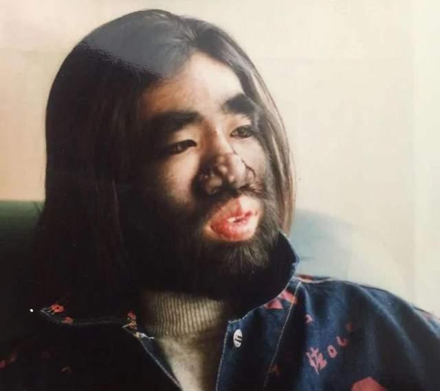 全身長滿毛！剛出生「就被科學家研究」　長大後「被人花1000萬包裝」42歲娶90後嬌妻
