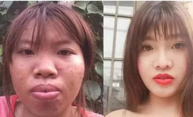 越南「醜姑娘」整容成功嫁富二代！「生下女兒後」原形畢露被拋棄　現狀曝光：不值得