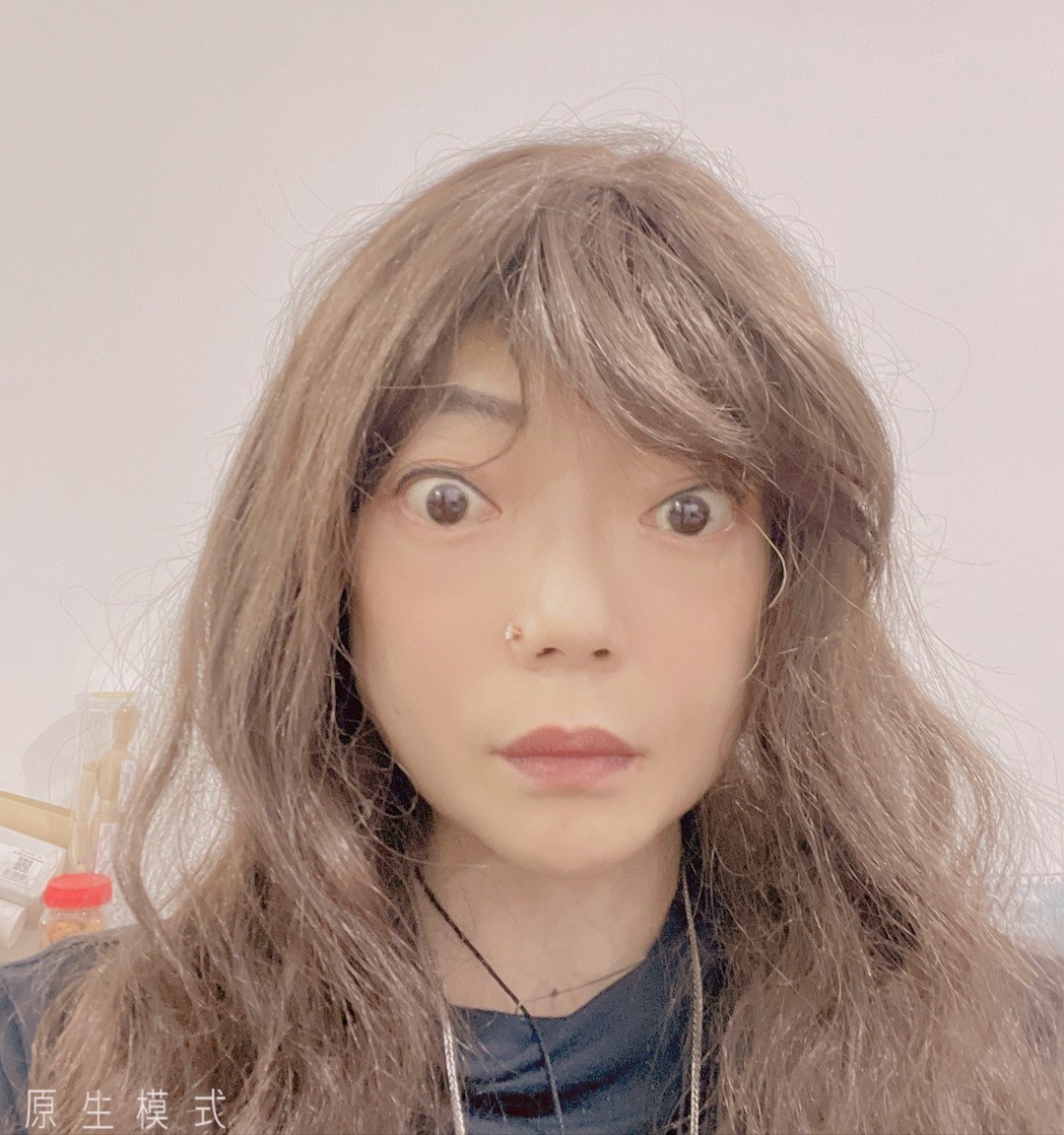 瘦到只有22公斤！她嫁入豪門8年「因患罕見疾病」被掃地出門　前夫拖欠贍養費「靠頑強求生欲」和病魔做鬥爭