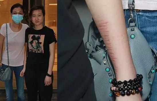 被嫌棄的一生！小龍女吳卓林「母拿她當上位籌碼」親父始終不認　遠赴加拿大「放下過去陰霾」與同性女友生活