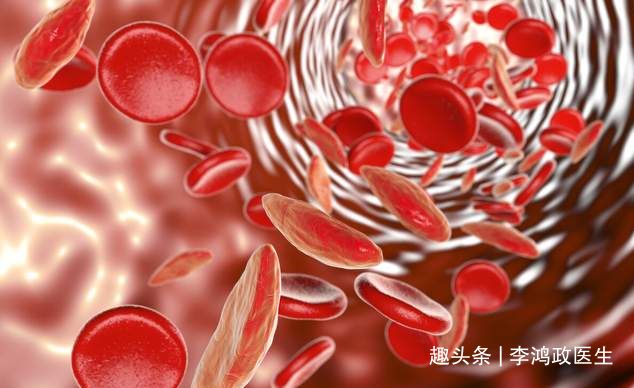 頭暈半年找不到原因！女子「臉色牙齦皆蒼白」以為貧血　檢查結果「問題竟是在胃部」：小細節恐喪命