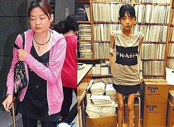 22歲放棄牛津嫁豪門！因丈夫3個字「摘掉腸胃」暴瘦至44斤　「又被設計掃地出門」後另娶她人