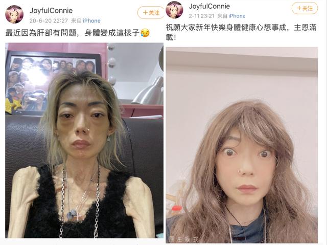 22歲放棄牛津嫁豪門！因丈夫3個字「摘掉腸胃」暴瘦至44斤　「又被設計掃地出門」後另娶她人