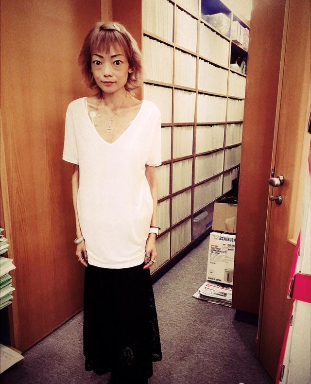 22歲放棄牛津嫁豪門！因丈夫3個字「摘掉腸胃」暴瘦至44斤　「又被設計掃地出門」後另娶她人