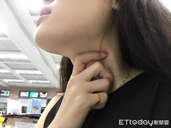 完全沒症狀！30歲女子「確診甲狀腺癌」她震驚：沒家族病史　醫生示警「出現此徵兆快就醫」