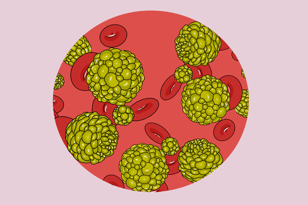 一確診就是晚期!身體5個信號是「體內有癌」 發現2個以上儘早檢查「癌症前兆」不要忽視了