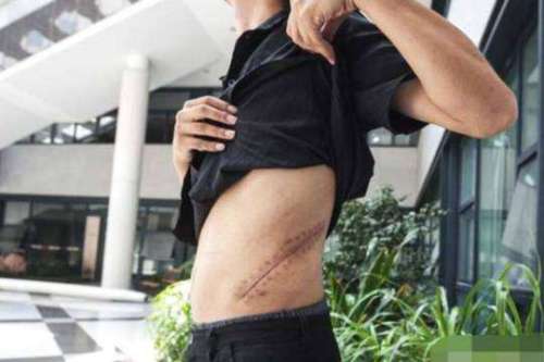 「腎一顆就夠用！」17歲少年「為買iPhone賣腎」驕傲大喊超值得　10年後「27歲現況曝光」父母心痛一生