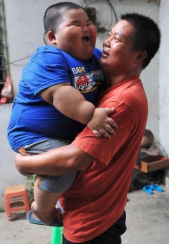 小六男童患脂肪肝!媽不解喊「都吃清蒸水煮」戒掉炸物 醫生「看完菜單後傻眼」:吃錯了啦